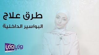 خيارات علاج البواسير الداخلية [upl. by Aivataj]