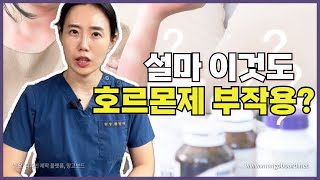 이것도 호르몬제 부작용 생각지 못했던 이상한 부작용들 알려드려요 [upl. by Dane668]