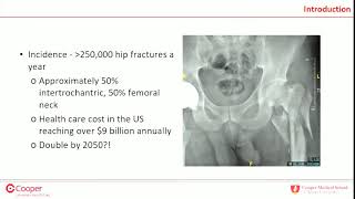 Hip Fractures  Everything You Need To Know  Dr Nabil Ebraheim [upl. by Swartz]