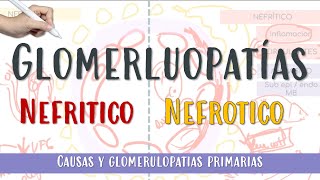 GLOMERULOPATIAS Nefrotico Nefritico GNRP Membranosa GNPE FocalySegmentaria Glomerulonefritis [upl. by Samale]