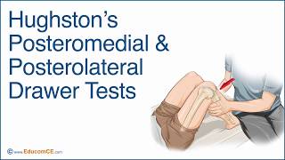 Hughston’s Posteromedial amp Posterolateral Drawer Tests [upl. by Notserp464]