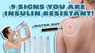 Insulin Resistance Symptoms WHY YOU CANT LOSE WEIGHT [upl. by Etnaed928]