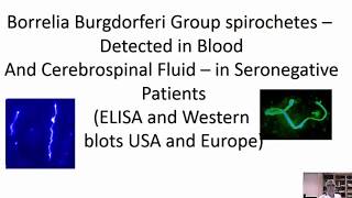 Alan Macdonald Multiple Sclerosis is a parasitosis [upl. by Aldarcie]