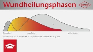 Wundheilungsphasen im Überblick  Exsudationsphase Granulationsphase Epithelisierungsphase [upl. by Luella]