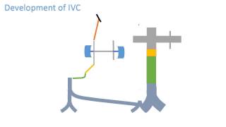 Inferior vena cava development [upl. by Essam]