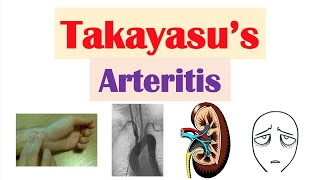 Polyarteritis nodosa  Circulatory System and Disease  NCLEXRN  Khan Academy [upl. by Donetta]