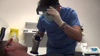 Cryotherapy treatment for skin [upl. by Ultan]