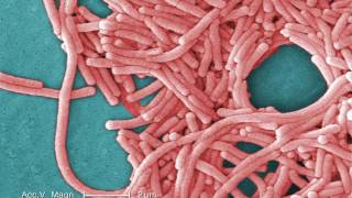 Legionnaires Disease What You Need to Know [upl. by Niraj]