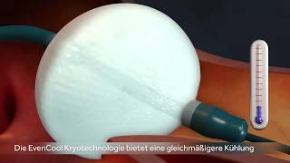 Medtronic  Katheterablation mit dem Kryoballon  Vorhofflimmern [upl. by Ahtennek267]