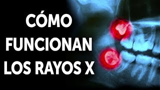 Cómo funcionan los fluoroscopios rayos X [upl. by Akiram]