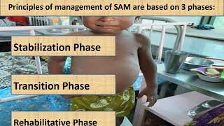 Severe Acute Malnutrition Part 14  Appetite test  Pediatrics [upl. by Normalie]