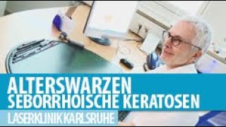 Seborrhoische Keratosen Alterswarzen [upl. by Aissat]