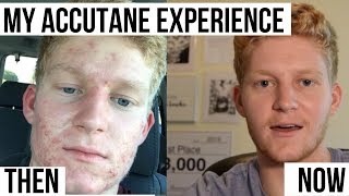 My Experience taking Accutane for 8 months [upl. by Root]