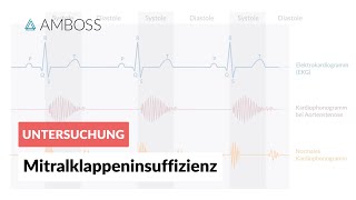 Mitralklappeninsuffizienz  Herzgeräusch  AMBOSS Video [upl. by Idou]