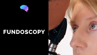 Fundoscopy Ophthalmoscopy  OSCE Guide  UKMLA  CPSA  PLAB 2 [upl. by Anaik564]