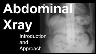 Abdominal Xray Introduction and Approach [upl. by Nilad]