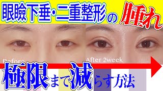 二重・眼瞼下垂整形の腫れを減らす方法を医師が解説【湘南美容クリニック眼瞼下垂・眉下切開・目の下のタルミ取りもOK】 [upl. by Anika]