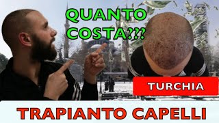 QUANTO COSTA il TRAPIANTO di CAPELLI in TURCHIA Ti racconto la VERITA [upl. by Hambley939]