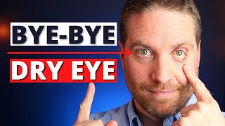 How To Get Rid Of Dry Eyes  4 Advanced Home Treatments [upl. by Collyer941]