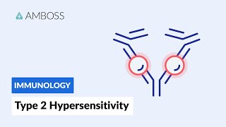 Trabeculectomy Surgery for Glaucoma Animation [upl. by Nyrahs]