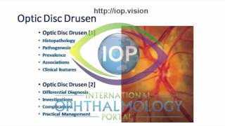 Optic Disc Drusen Part 1 Preview [upl. by Nailliw]