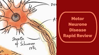 Motor Neurone Disease aka ALSLou Gehrigs disease rapid review [upl. by Dorthy]