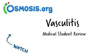 Vasculitis  Clinical Presentation [upl. by Jedlicka]