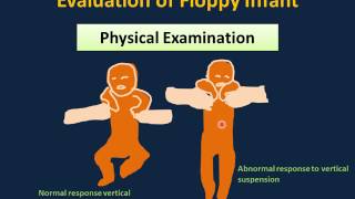 What is Spasticity [upl. by Shaffert]