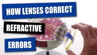 How Opticians Use Lenses To Correct Refractive Errors [upl. by Analra662]