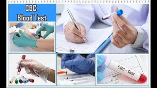 CBC Blood Test  Explained with Normal Range [upl. by Ariaj240]