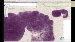 Histology Helper  Lymphoid Tissue Histology [upl. by Saxen167]