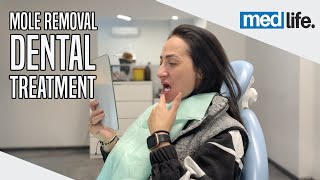 Ramonas Medical Journey in Turkey  Mole Removal amp Dental Treatment [upl. by Arbba427]