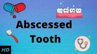 Abscessed tooth Causes SIgns and Symptoms Diagnosis and Treatment [upl. by Ynotna824]