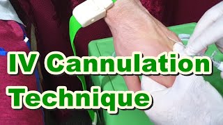 How to Insert IV Cannula  IV Cannulation Technique  Branula  Intravenous Catheter [upl. by Salema607]