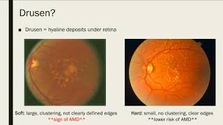 Vision Loss and Macular Degeneration [upl. by Darees]