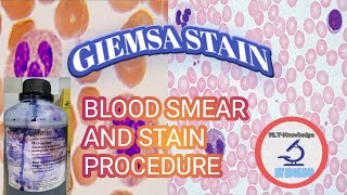 BLOOD SMEAR amp GIEMSA STAIN PROCEDURE [upl. by Alyek453]