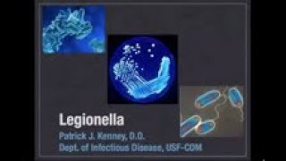 Legionella  Patrick Kenney MD [upl. by Nuahsad457]