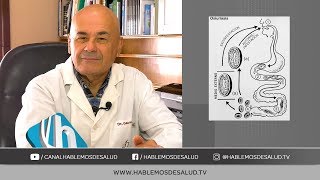 PARASITOSIS INTESTINAL  DR JORGE GAUNA [upl. by Rasaec]