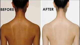 काली गर्दन को 5 मिनट में गोरा बना देंगा ये नुस्खा की देखकर चुप रह जाओगेDark NeckBest Beauty Tips [upl. by Cheney]