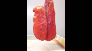 Smokers Lungs VS Nonsmokers Lungs [upl. by Viviyan]