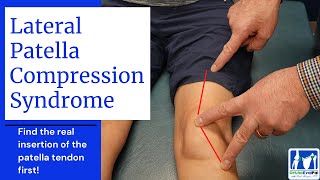 Lateral Patella Compression Syndrome LPCS [upl. by Naxor]