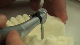 Dental implant surgery training video [upl. by Leirbma]