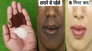 5 मिनट में चेहरा साफ और गोरा करने का घरेलू उपाय  Skin Whitening  Gora hone ka tarika [upl. by Sevein5]