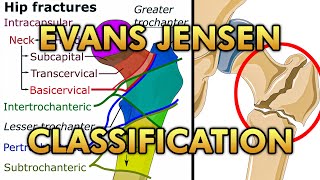 Top Exercises amp Stretches After Healed Shoulder Fracture Humerus Scapula or Clavicle [upl. by Ytomit938]