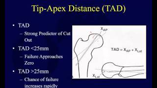 THUMB EXERCISES AFTER SURGERY or FRACTURE [upl. by Gurolinick]