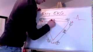 Easy EKG Einthovens Triangle [upl. by Alyehc92]