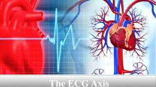 ECG Axis Tutorial Part 1  Einthovens Triangle [upl. by Lurette462]