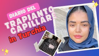 Vlog IL MIO TRAPIANTO CAPILLARE ALLE SOPPRACIGLIA IN TURCHIA [upl. by Anesusa]