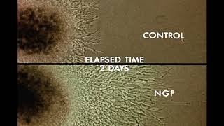 8 Response of Cells to Nerve Growth Factor NGF [upl. by Tezil]