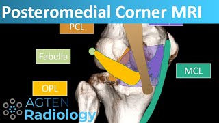 Posteromedial Corner Anatomy on Knee MRI [upl. by Aymik853]